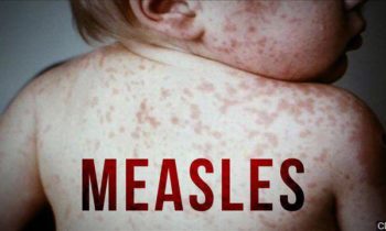 Two measles cases from exposure at Portland, Oregon airport