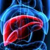 AI Helps Spot Liver Disease Early