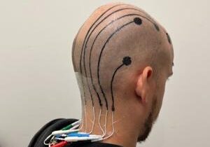 Temporary Scalp Tattoo Can Track Your Brainwaves