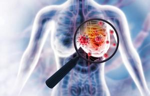 Exercise Prior to Cancer Diagnosis May Help Slow Disease Progression